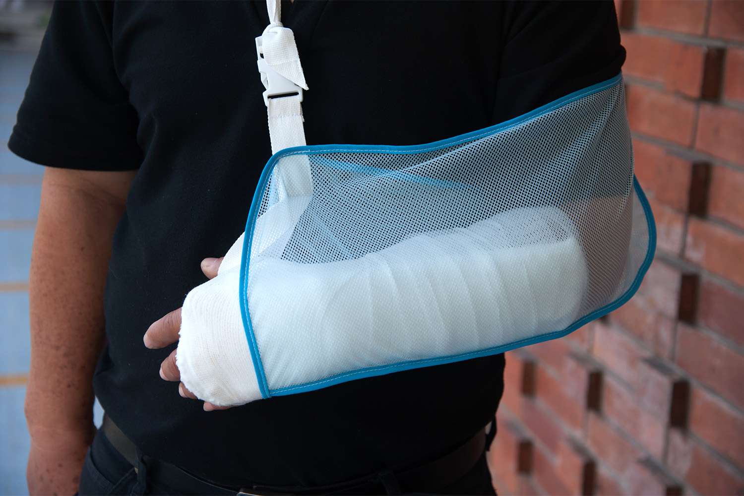 Person with arm injury